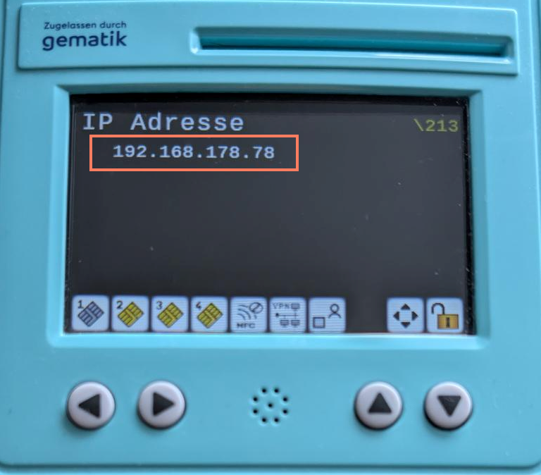 Angezeigte IP-Adresse